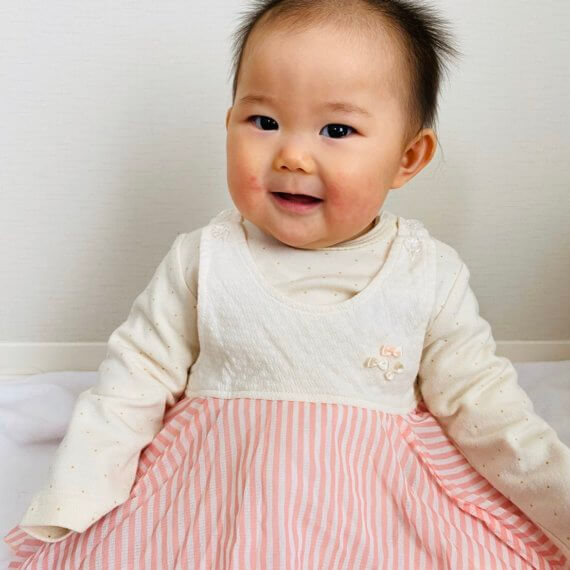 Look #6 Girly Girl Stylist: Chie K ai Outfit: Long polka dot sleeve, Salmon pink stripe dress Model: Yui Emoto Photographer: Chiho Emoto Location: Amagasaki, Hyogo